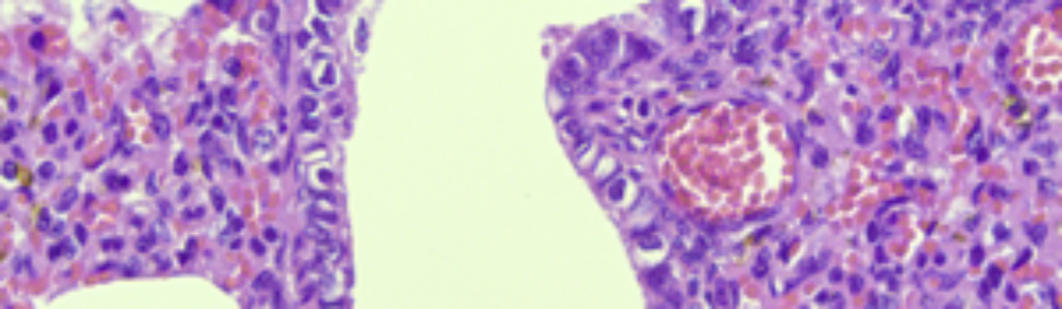 Badanie histopatologiczne – ważne wsparcie diagnostyczne